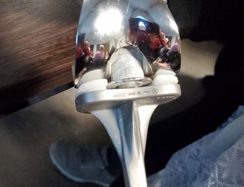 Knieschmerzen – was nun?